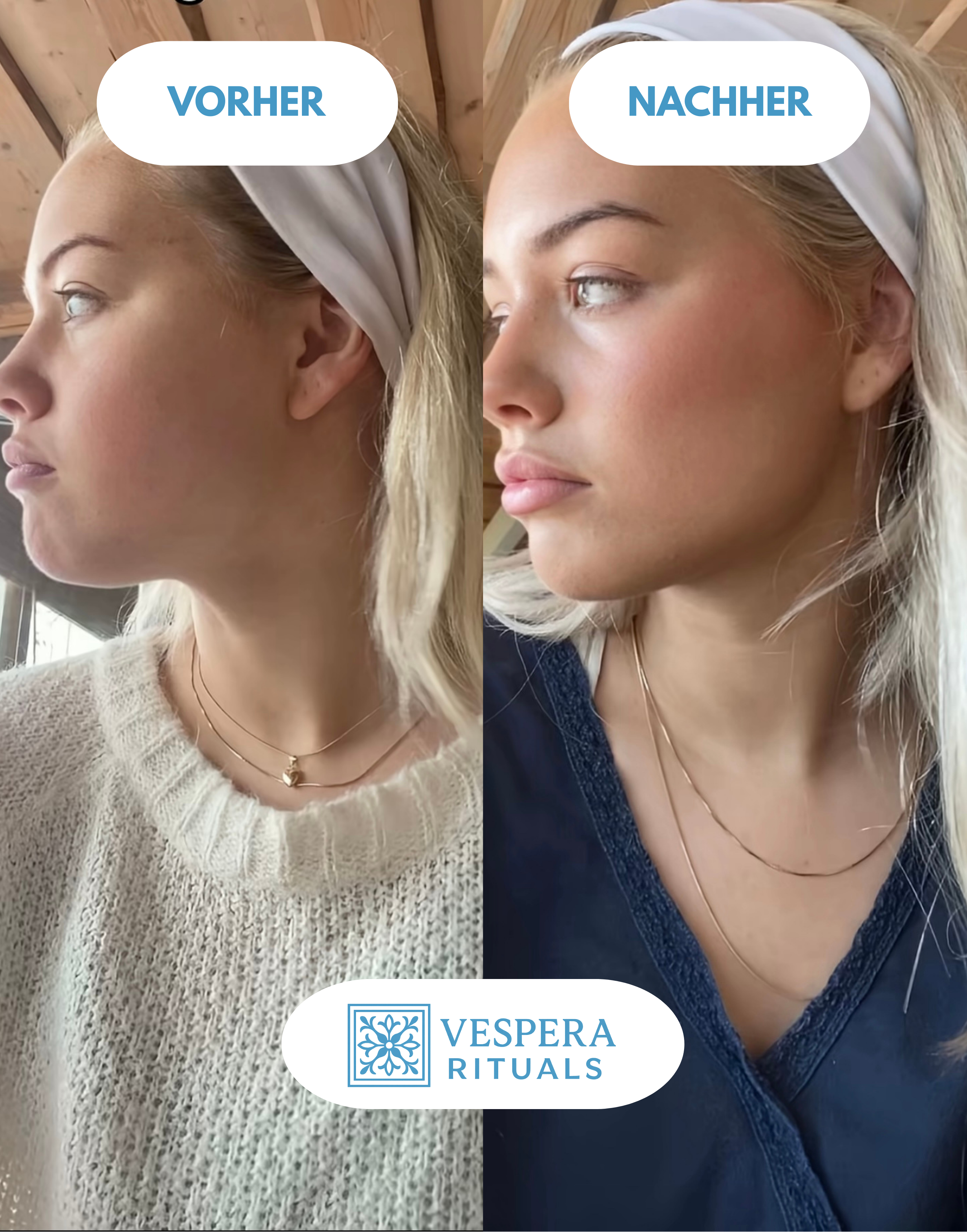 EMS Gesichtsmassagegert | Vespera Clear & Lift | 3-Farben Lichttherapie | Mikrostrom Technologie | Strafft die Jawline | Anti-Aging Gert | Gesichtslifting Vespera Rituals EMS Gesichtsmassagegert | Vespera Clear & Lift | 3-Farben Lichttherapie | Mikrostrom Technologie | Strafft die Jawline | Anti-Aging Gert | Gesichtslifting Vespera Rituals