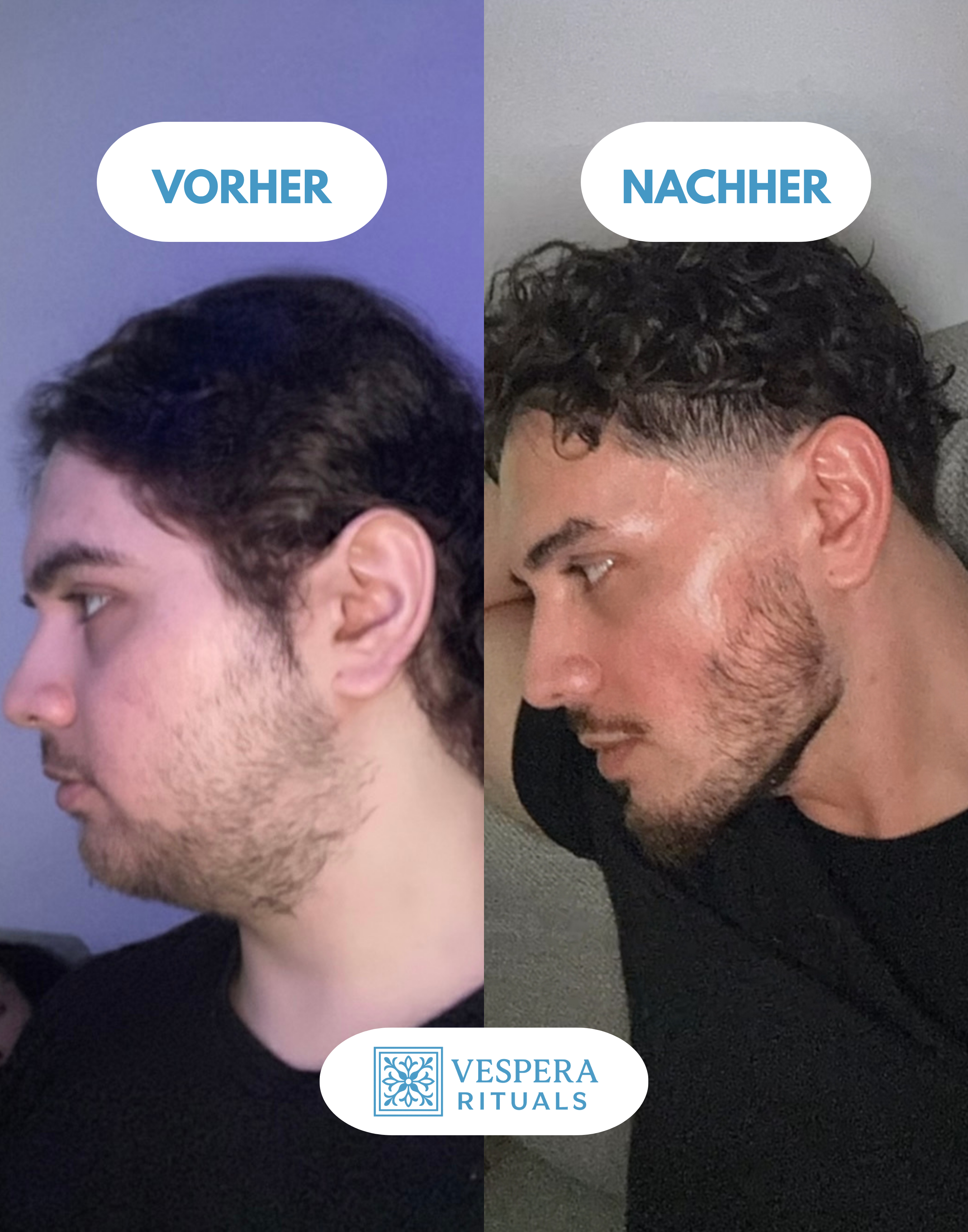 EMS Gesichtsmassagegert | Vespera Clear & Lift | 3-Farben Lichttherapie | Mikrostrom Technologie | Strafft die Jawline | Anti-Aging Gert | Gesichtslifting Vespera Rituals EMS Gesichtsmassagegert | Vespera Clear & Lift | 3-Farben Lichttherapie | Mikrostrom Technologie | Strafft die Jawline | Anti-Aging Gert | Gesichtslifting Vespera Rituals