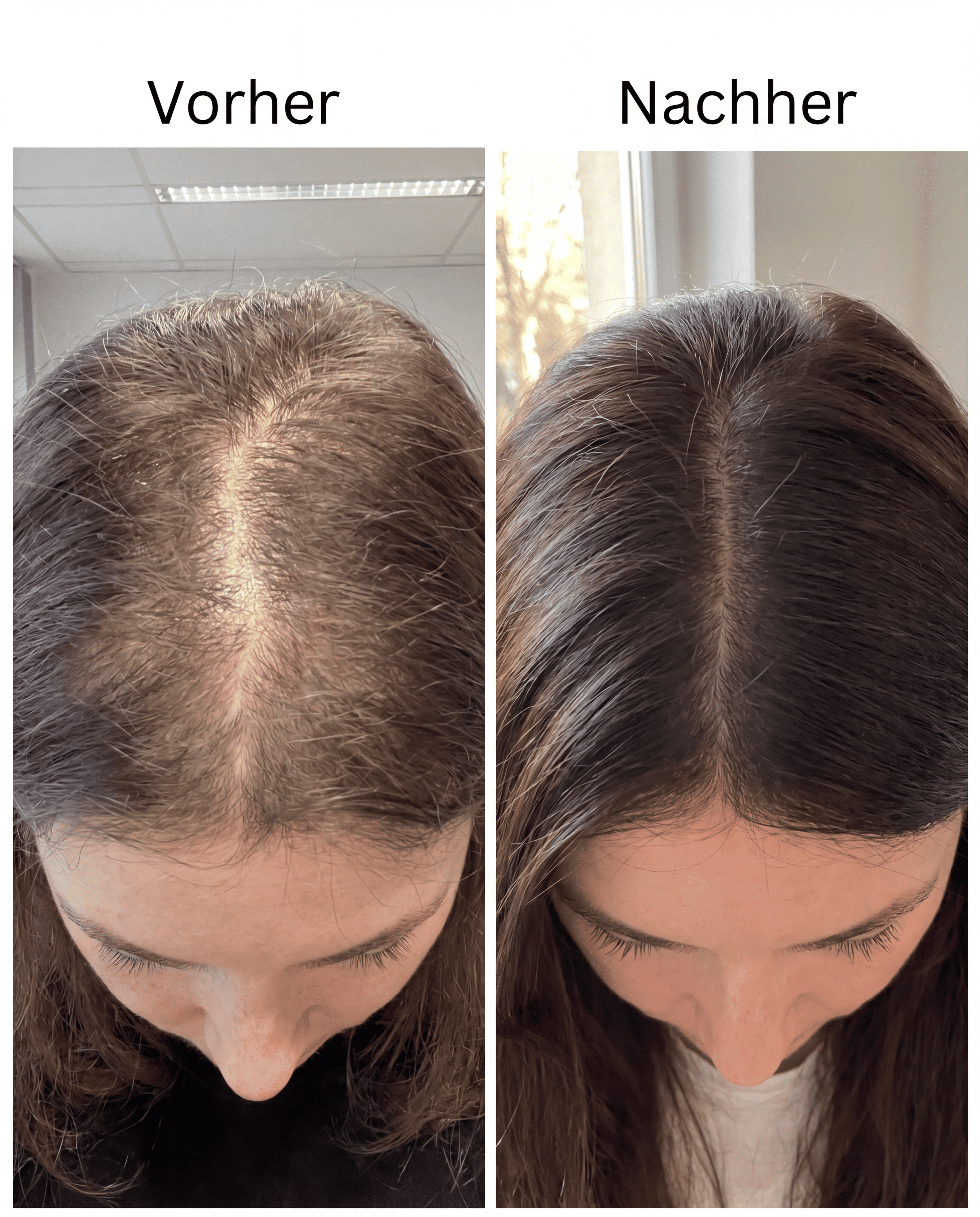 Vespera Growth Elixir™